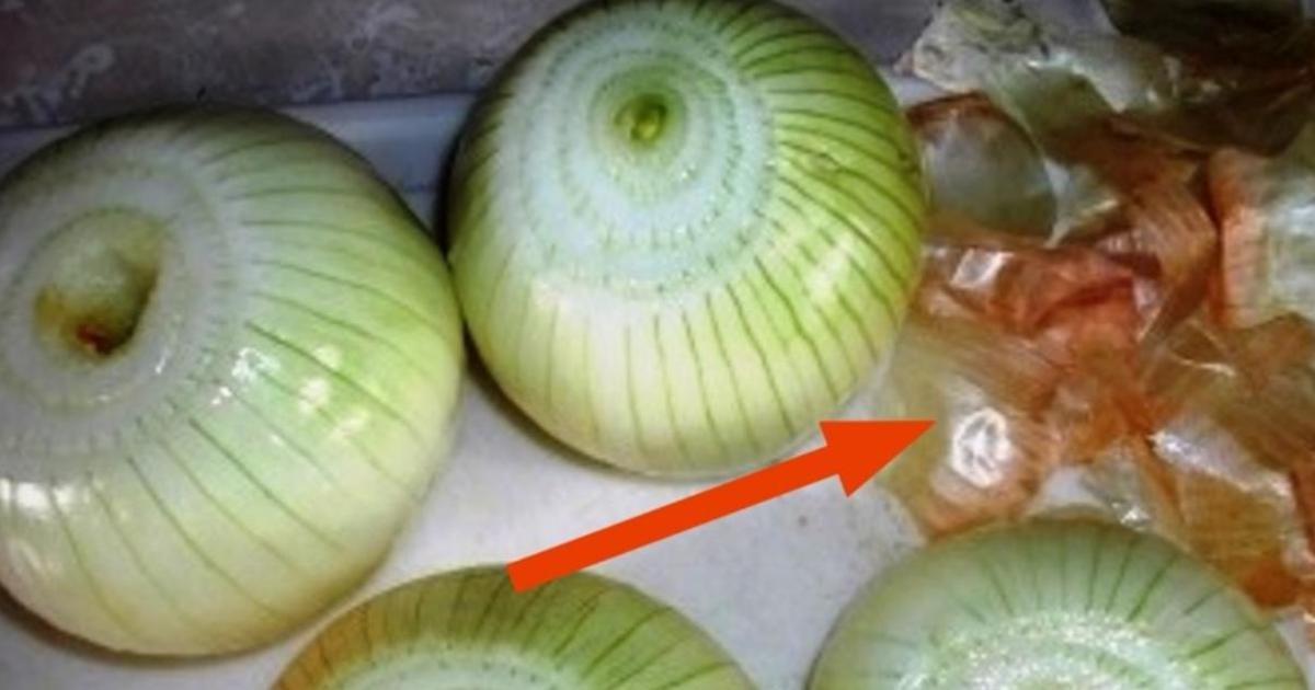 6 reasons why you should never throw onion skins in the garbage again